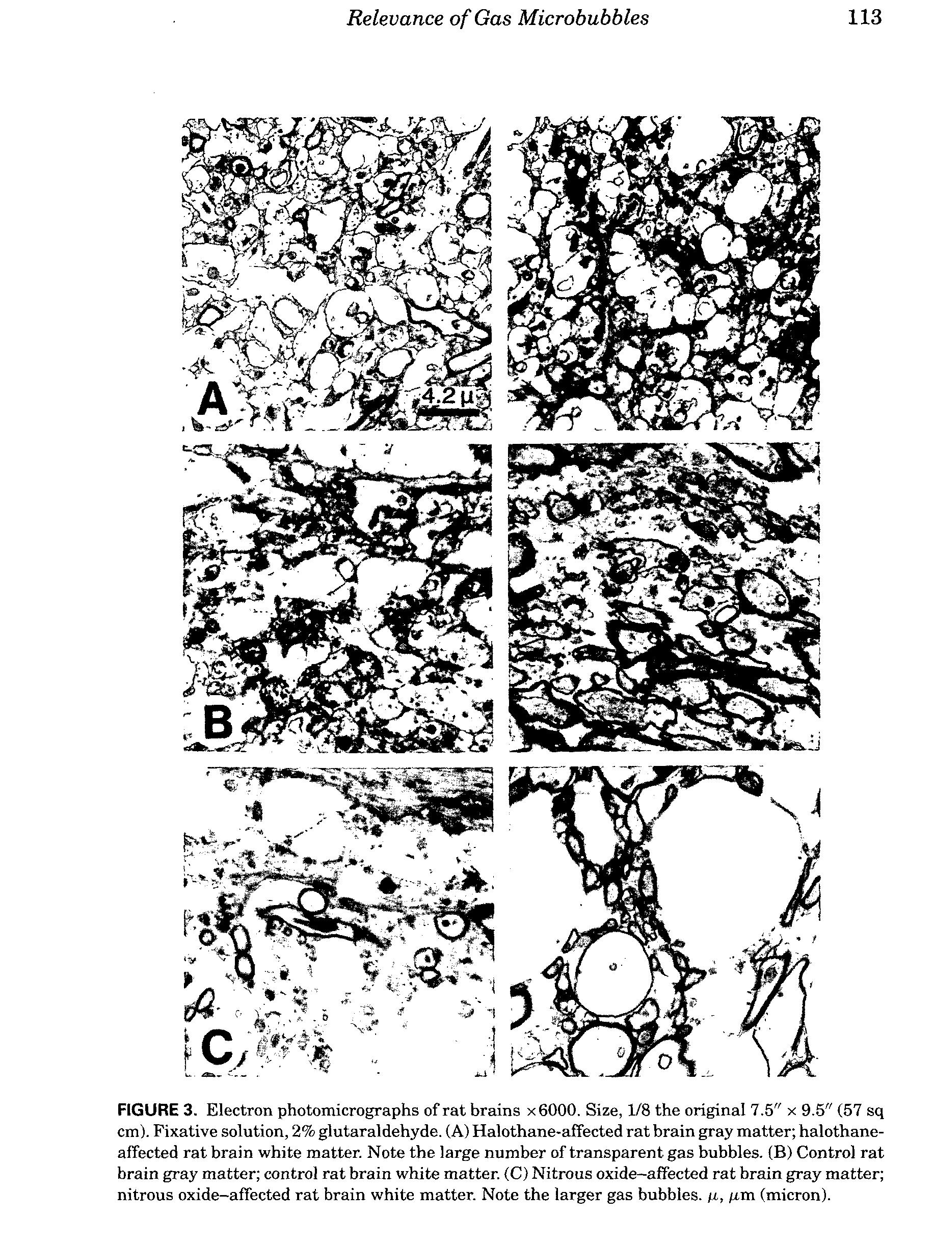 Method of use of Xenon-133 for the treatment of AIDS, other viral and non-viral infections