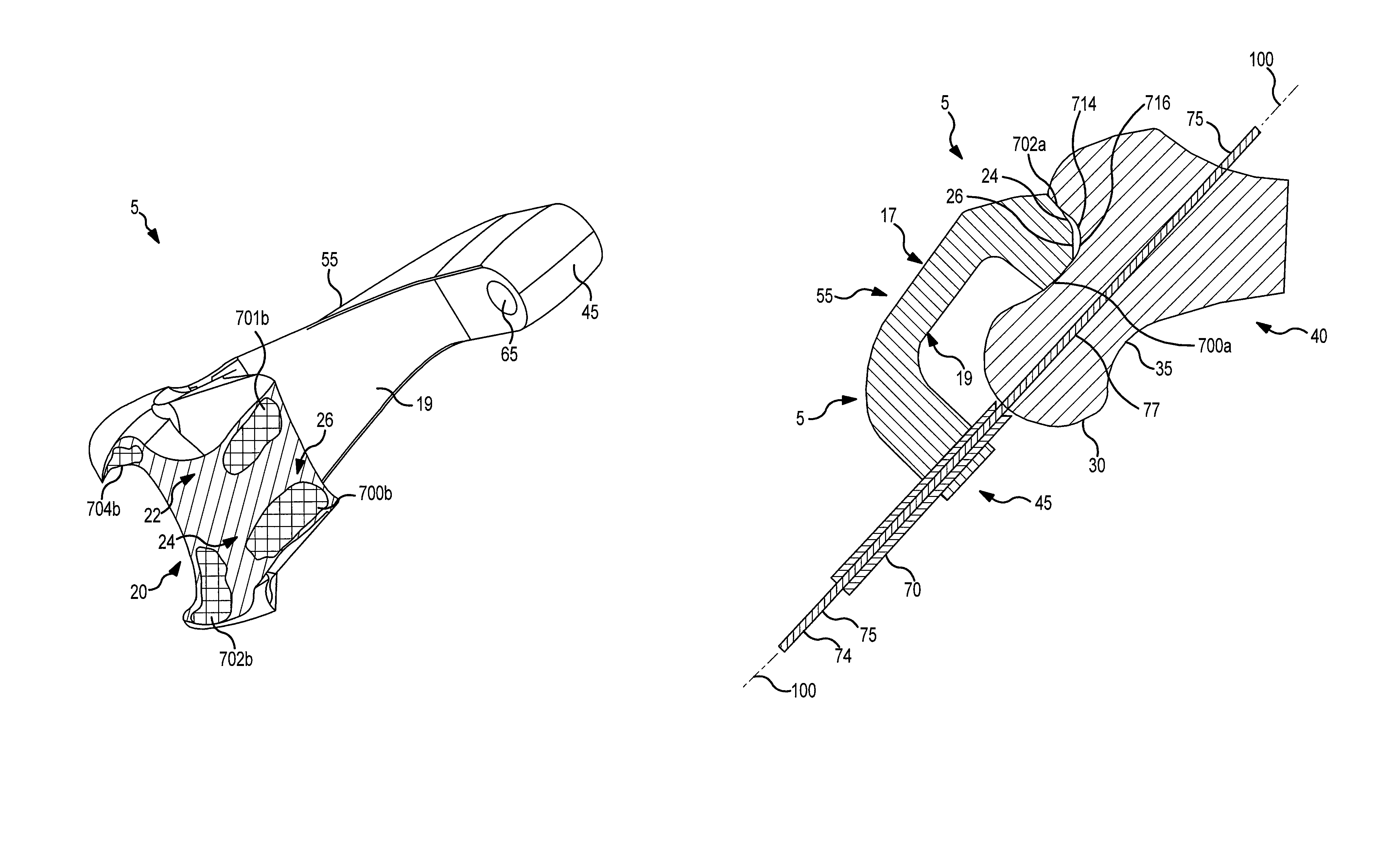 Hip resurfacing surgical guide tool