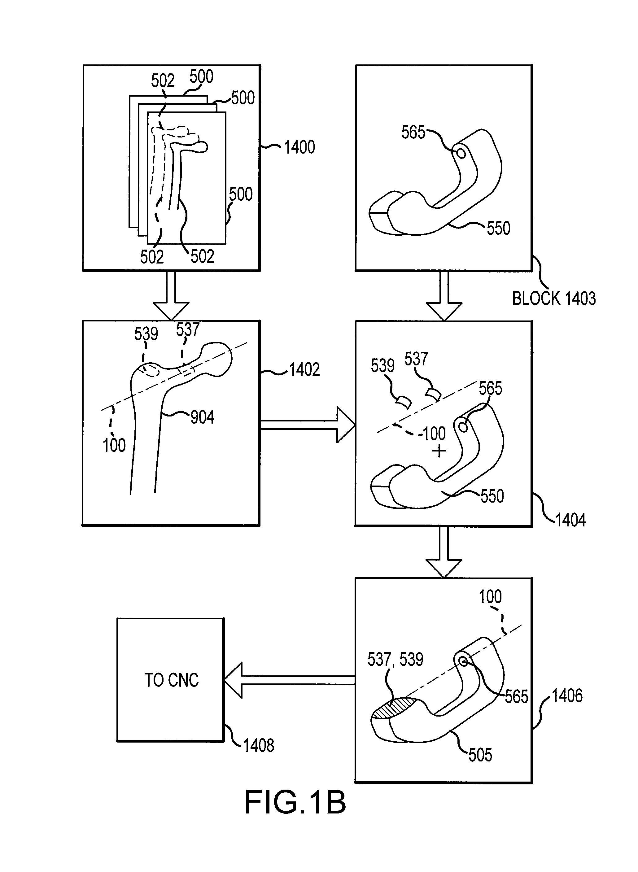 Hip resurfacing surgical guide tool