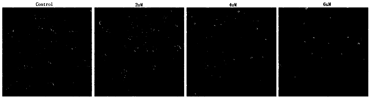 Application of 3β-Hydroxydesmegamusthreamide 3-o-β-d-glucopyranoside in the preparation of antitumor drug preparations