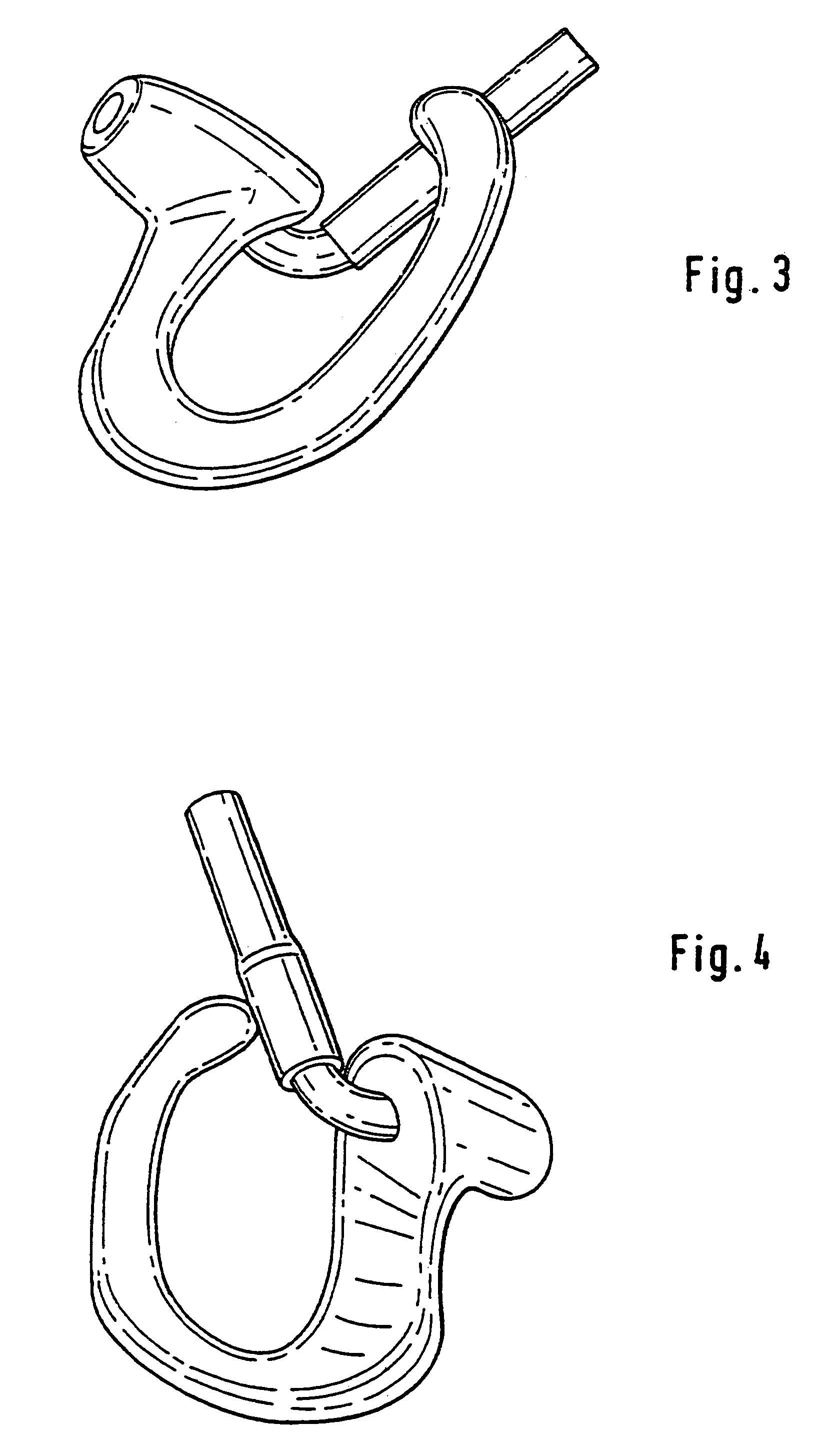 Otoplasty for behind-the-ear (BTE) hearing aids