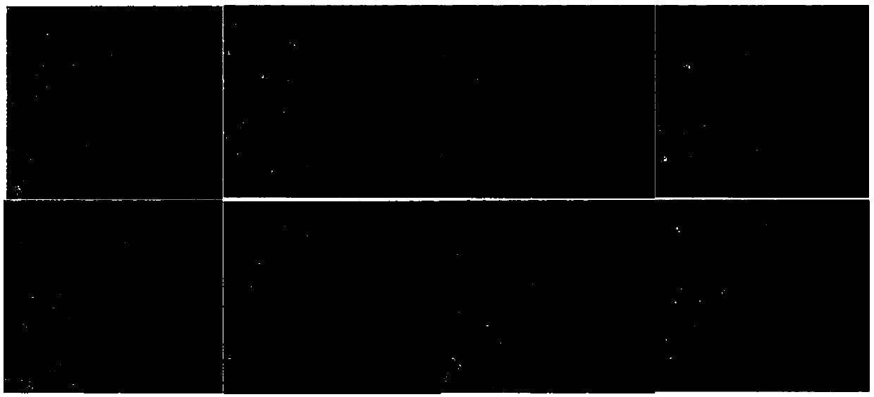 Application of loureirin A to preparation of medicine for preventing or treating diabetic angiopathy