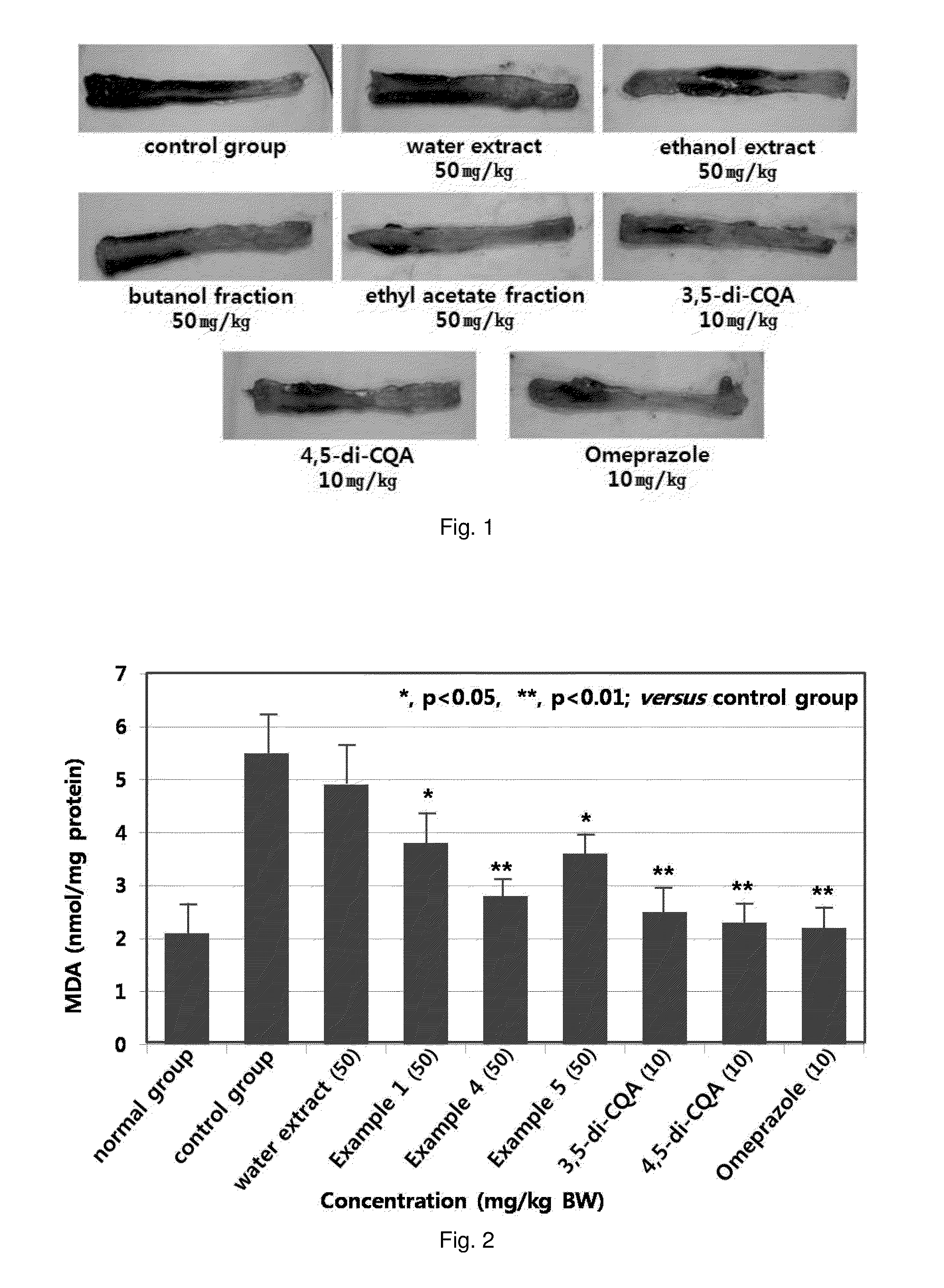 Pharmaceutical composition comprising extract of lonicera japonica for prevention and treatment of gastroesophageal reflux disease