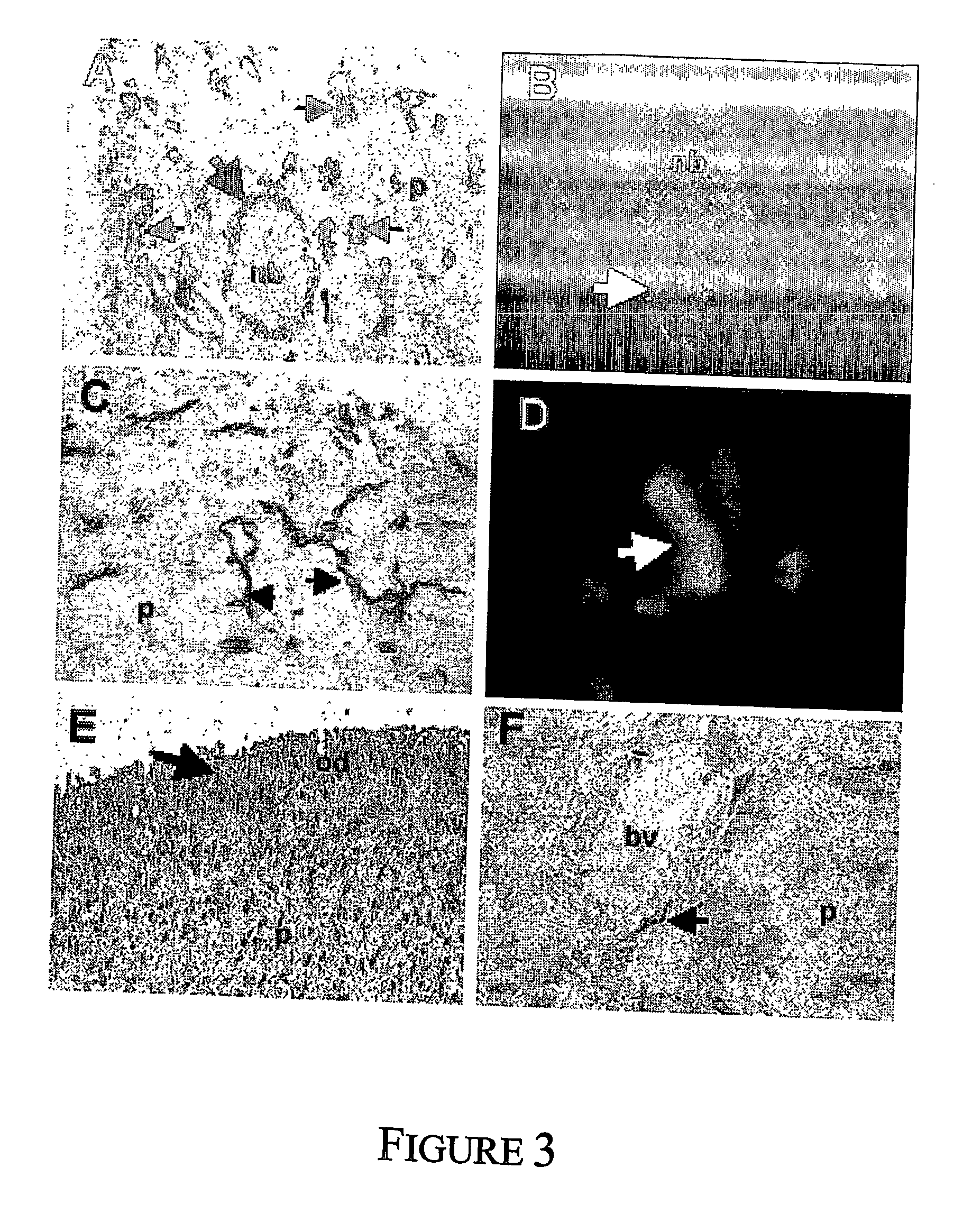 Perivascular mesenchymal precursor cell induced blood vessel formation