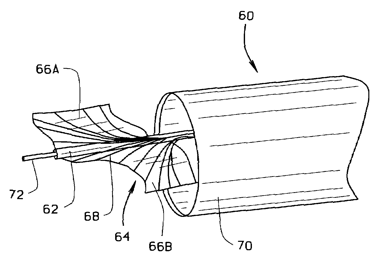 Expandable laser catheter