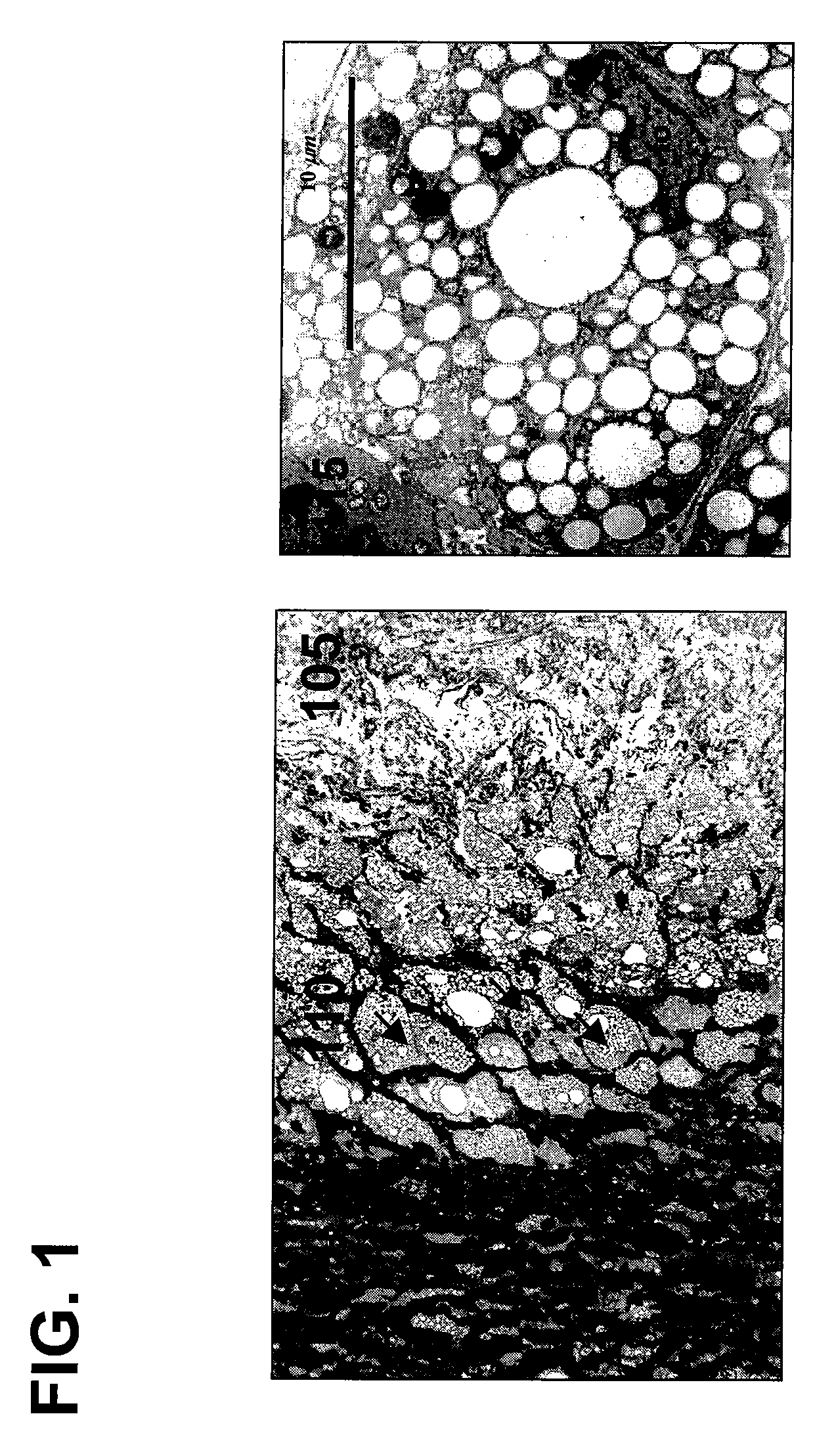 System and method for providing cell specific laser therapy of atherosclerotic plaques by targeting light absorbers in macrophages