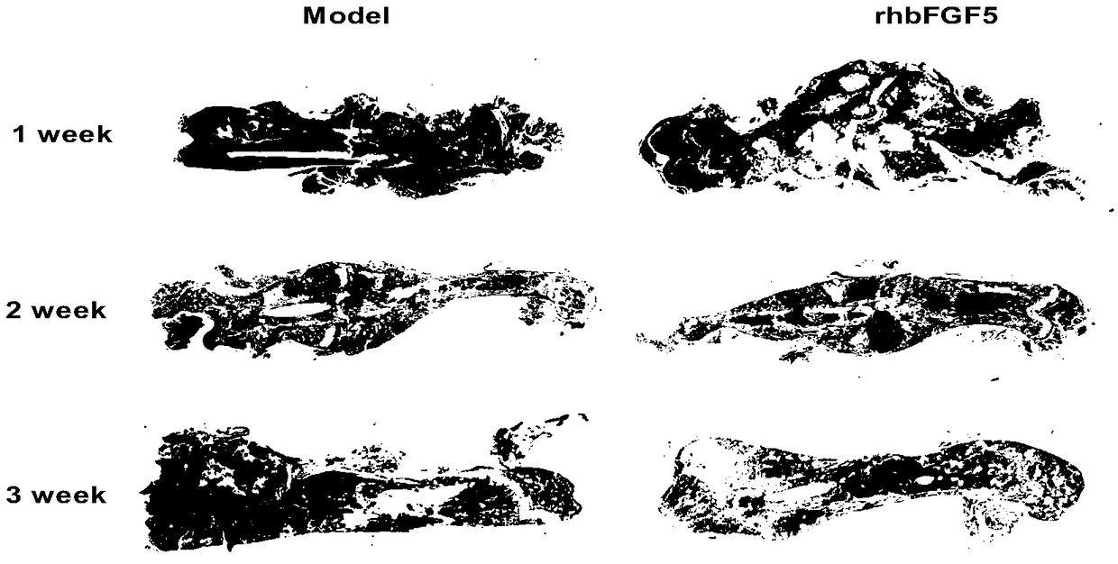 Application of recombinant human basic fibroblast growth factor-5 in promotion of fracture healing