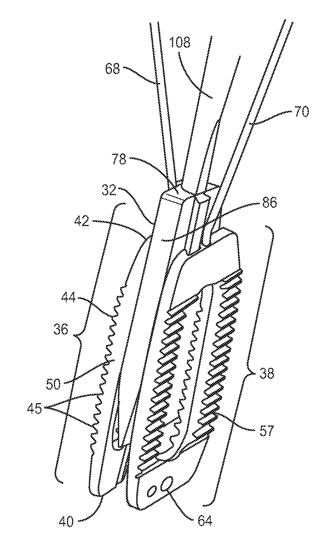 Interbody implant system and methods of use