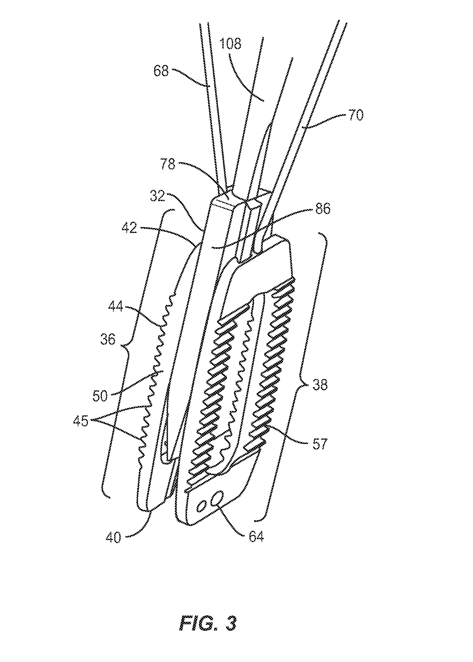 Interbody implant system and methods of use