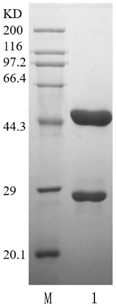 Anti-human abnormal prothrombin antibody and its application