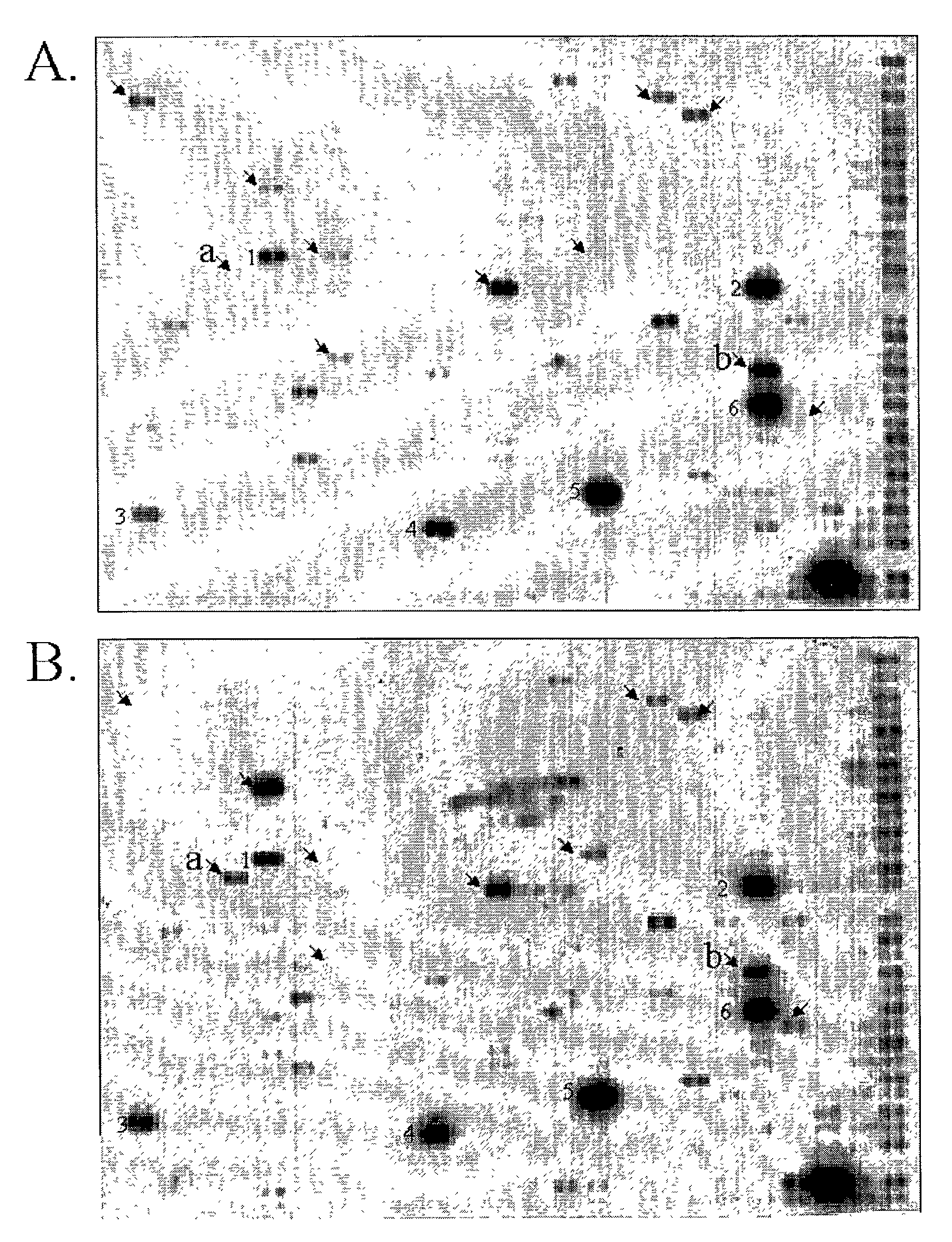 Method for using thymosin β-10 for gene therapy of solid malignant tumors