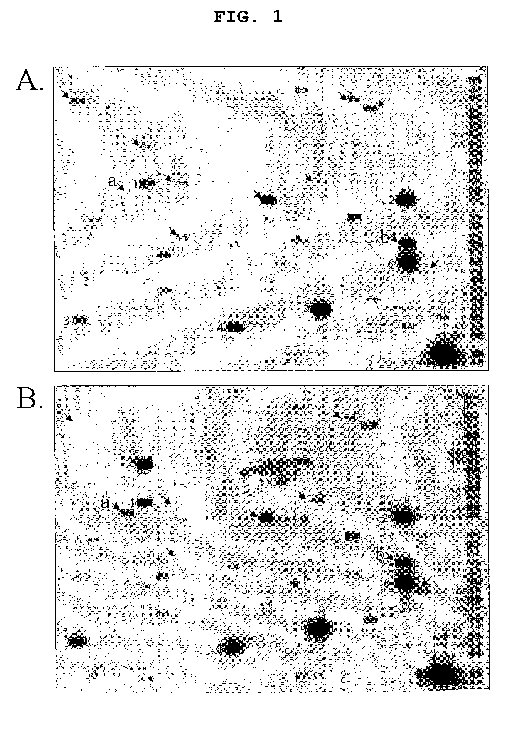 Method for using thymosin β-10 for gene therapy of solid malignant tumors