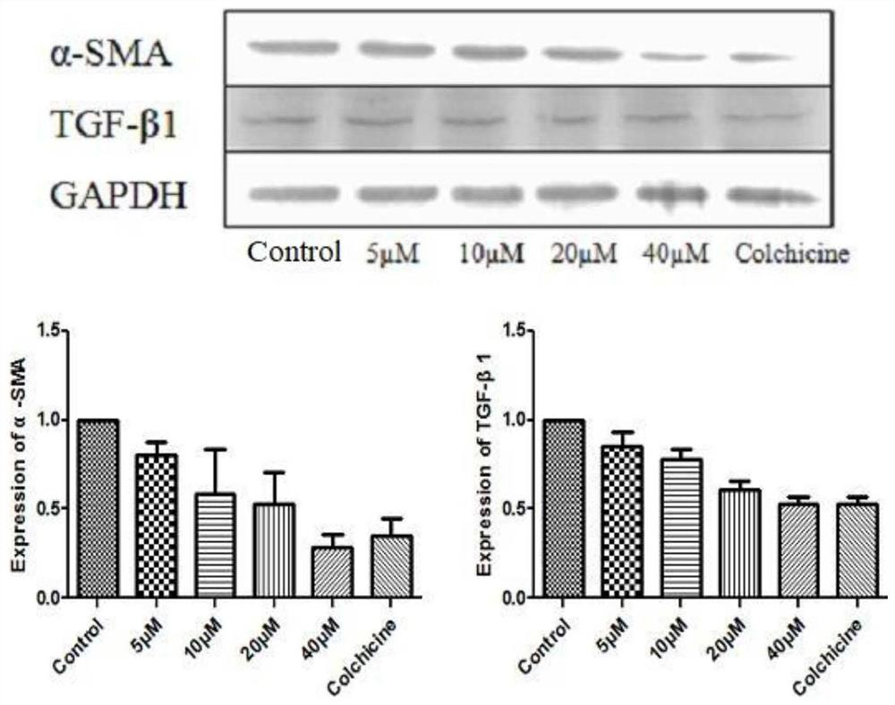 Application of thiazolopyrone analogs in the preparation of anti-hepatic fibrosis or anti-acute liver injury drugs