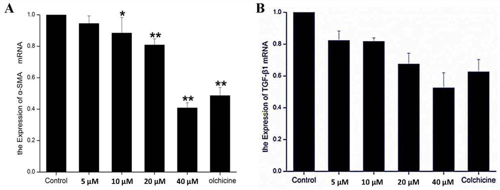 Application of thiazolopyrone analogs in the preparation of anti-hepatic fibrosis or anti-acute liver injury drugs