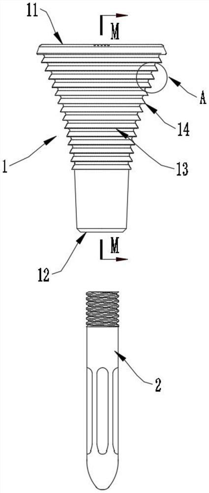 Knee joint revision file