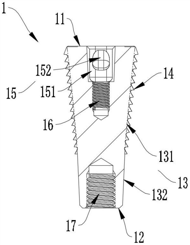 Knee joint revision file