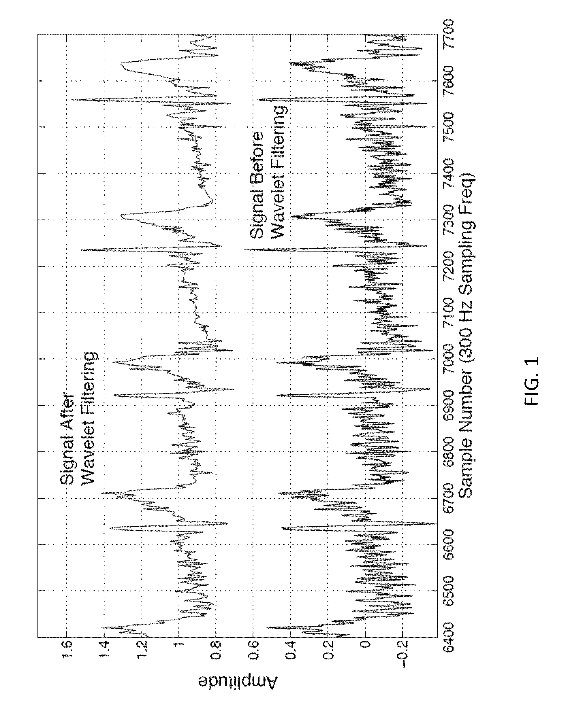 Electrocardiogram signal detection