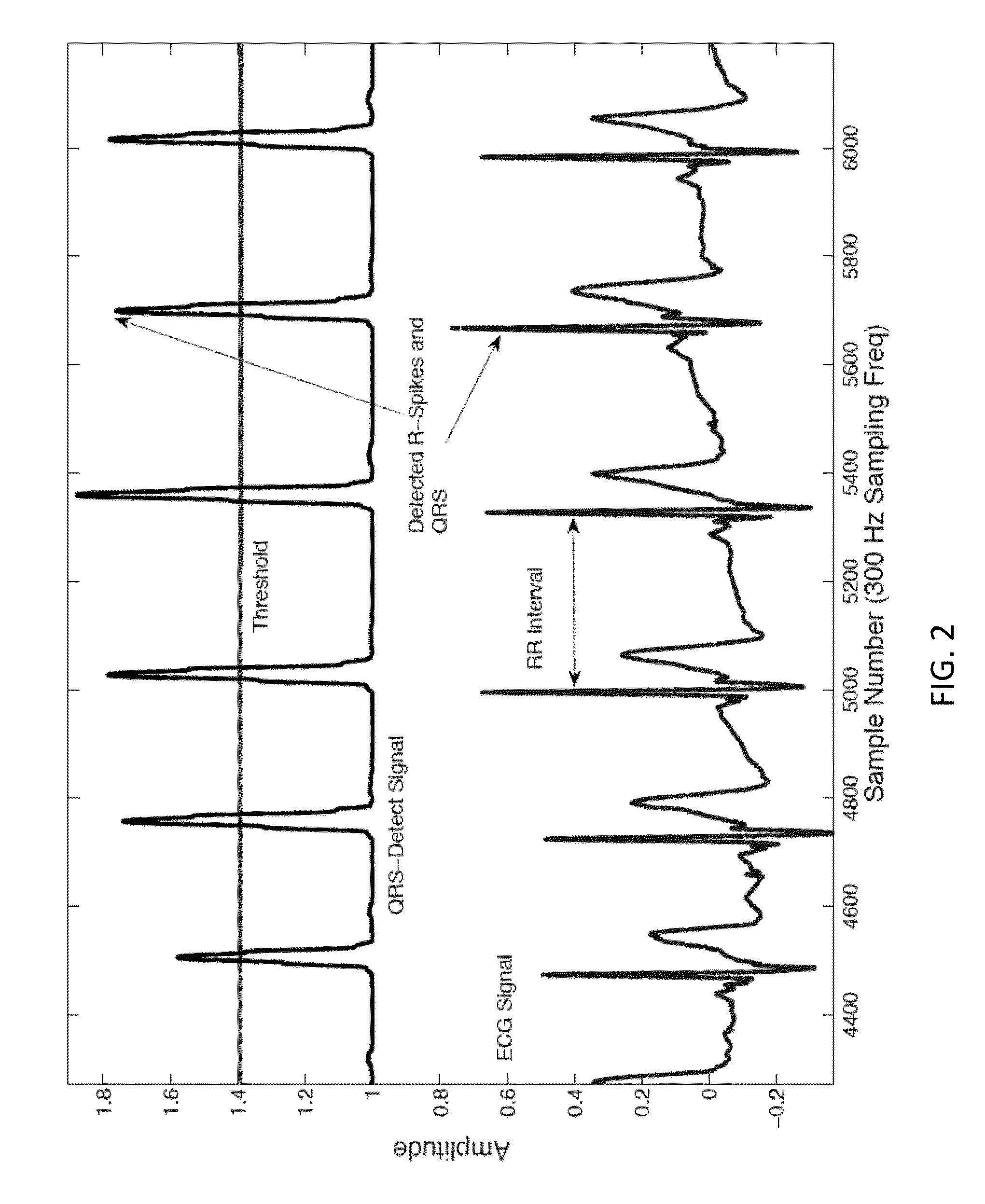 Electrocardiogram signal detection