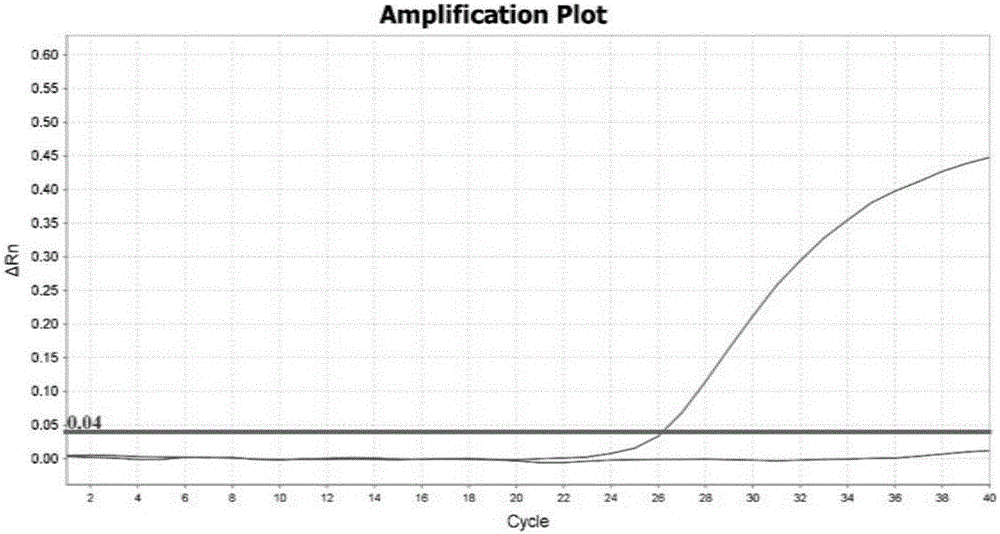 Kit for simultaneously detecting SLCO1B1, APOE and LDLR gene multisite mutation