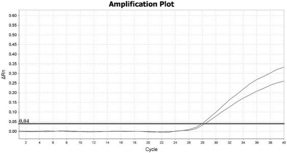 Kit for simultaneously detecting SLCO1B1, APOE and LDLR gene multisite mutation