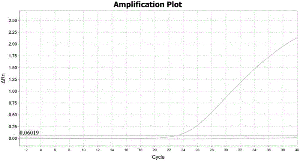 Kit for simultaneously detecting SLCO1B1, APOE and LDLR gene multisite mutation