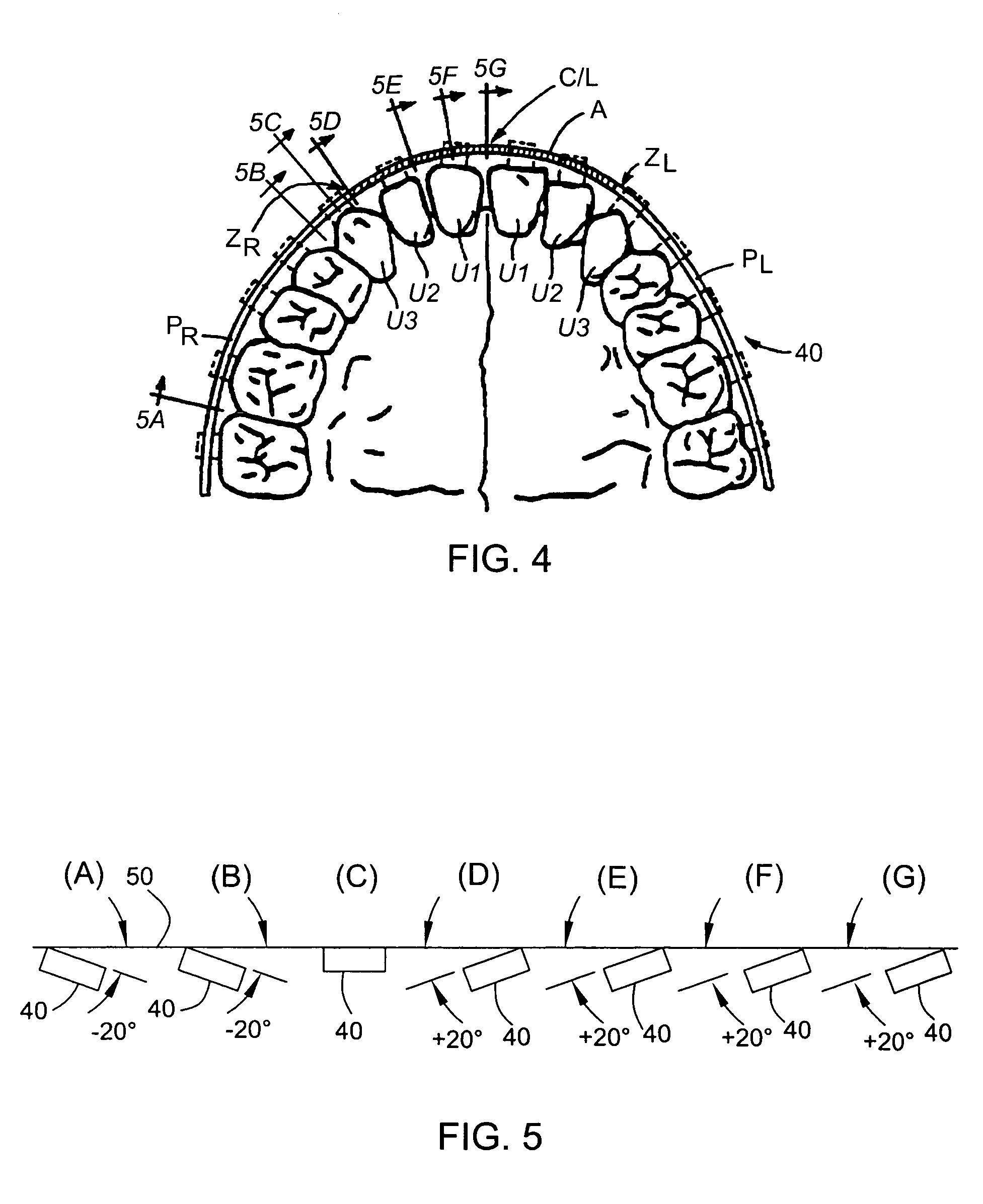 Torqued titanium-based archwire