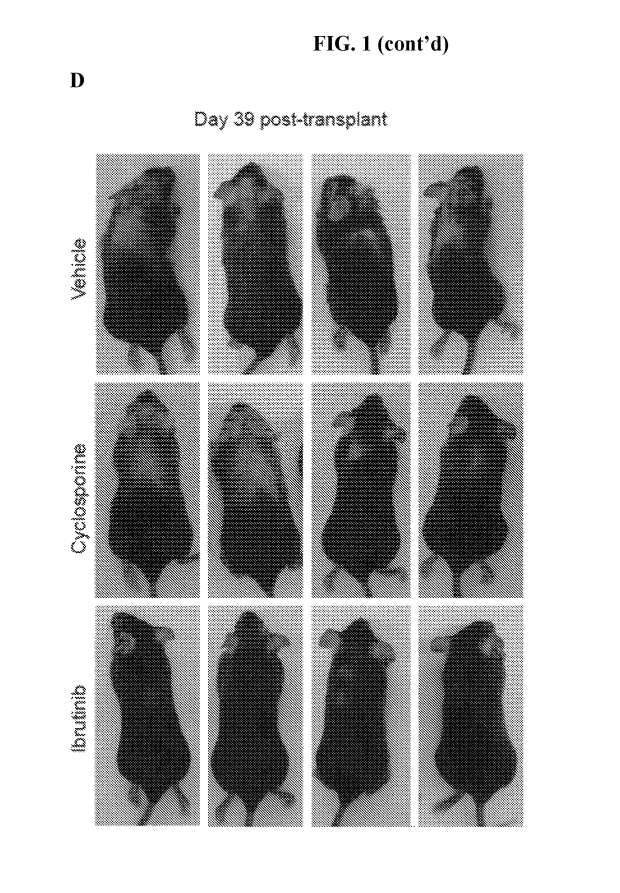 Methods of treating and preventing graft versus host disease