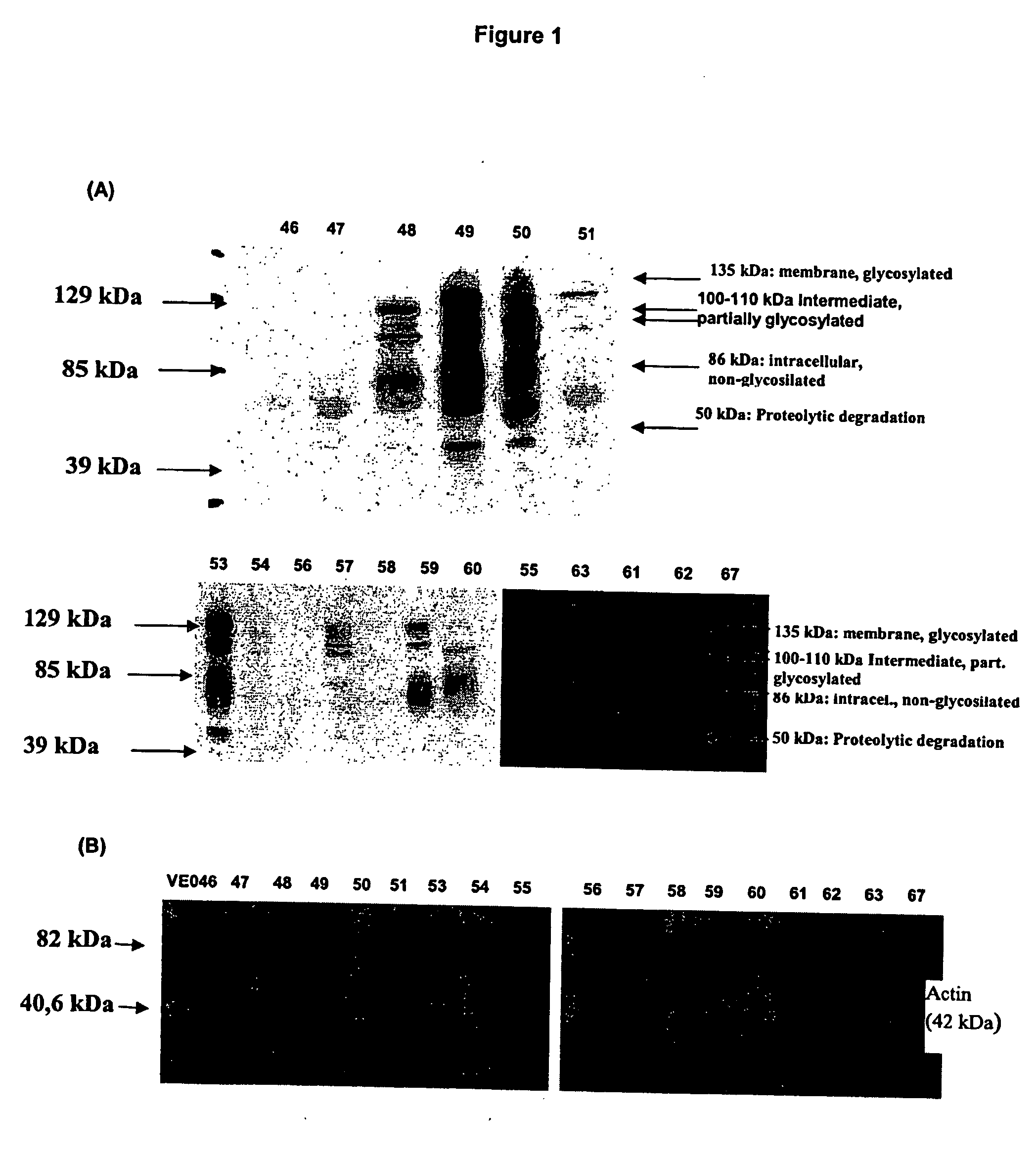 In vitro method to detect bladder transitional cell carcinoma