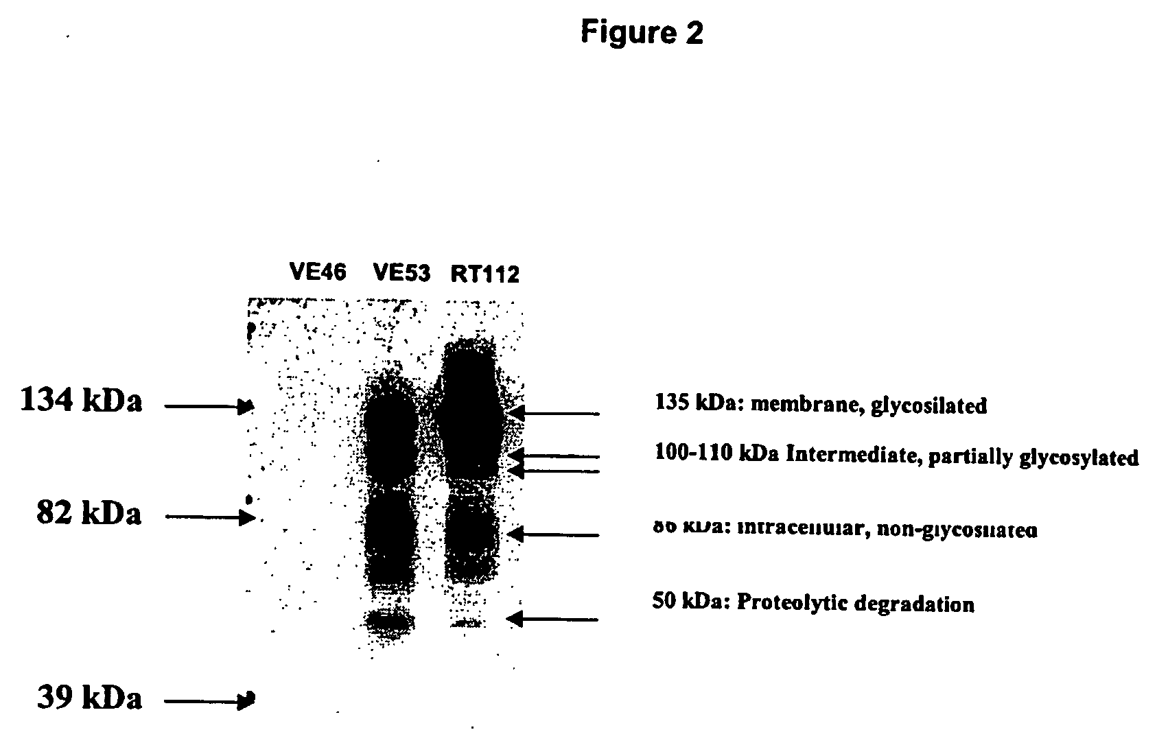 In vitro method to detect bladder transitional cell carcinoma