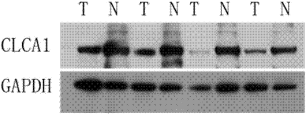 Human colorectal cancer protein mark CLCA1 (calcium-activated chloride channel 1) kit and application thereof