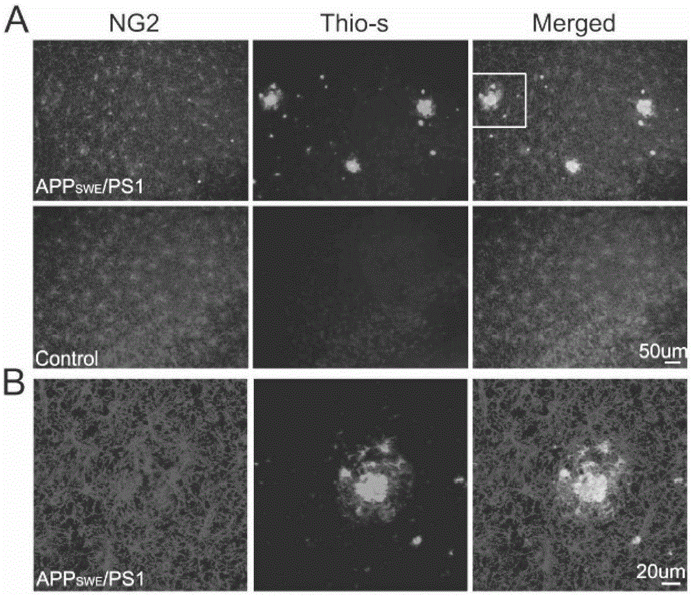 Cells for clearing amyloid polypeptide and application thereof