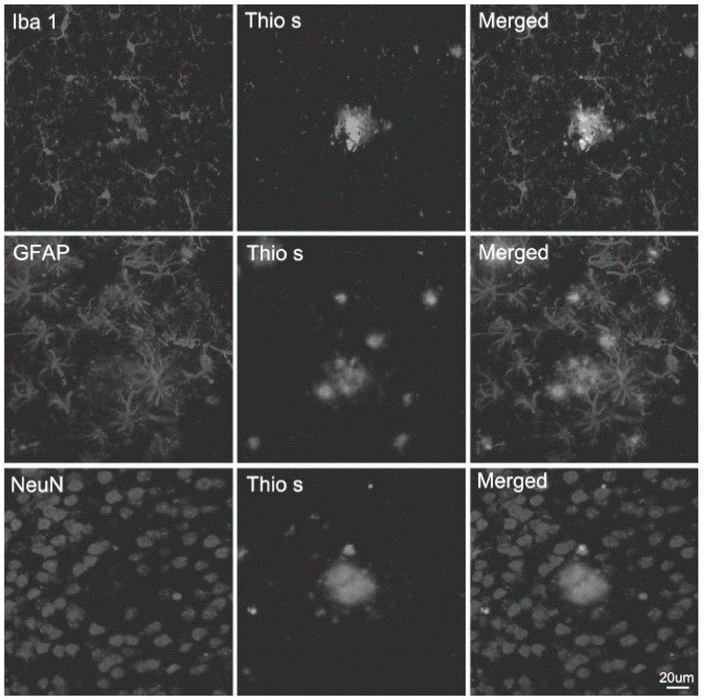 Cells for clearing amyloid polypeptide and application thereof