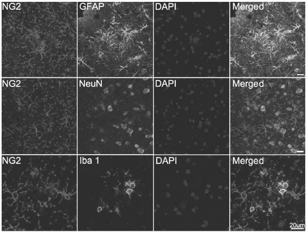 Cells for clearing amyloid polypeptide and application thereof