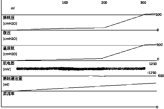 Method for double-cavity bladder clinical pressure measurement by silicon rubber catheter