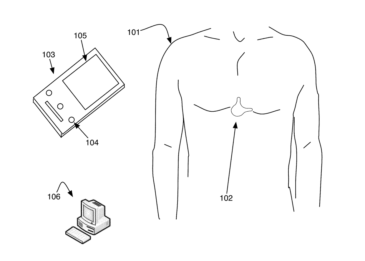 Electrocardiogram Device and Methods