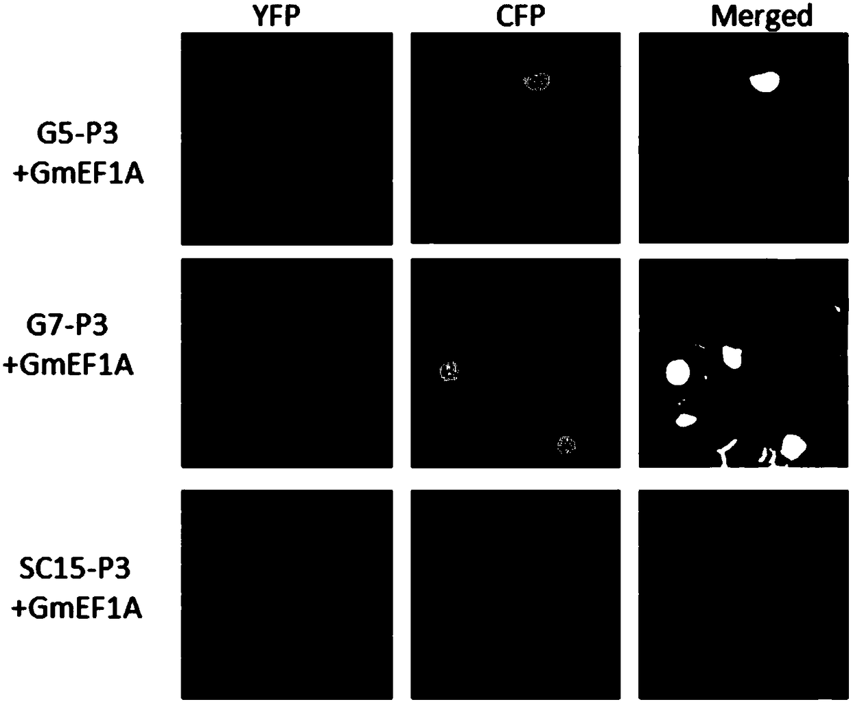 Application of Soybean Elongation Factor Family in Resistance to Soybean Mosaic Virus