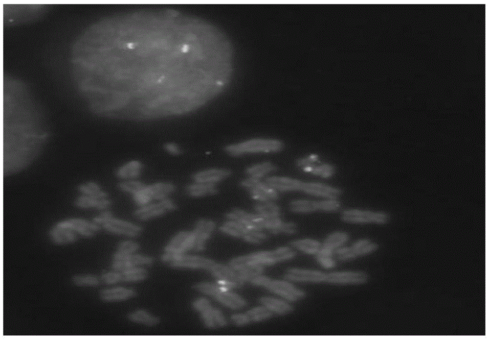 AML1 gene and ETO gene detection probe, preparation method thereof and reagent kit