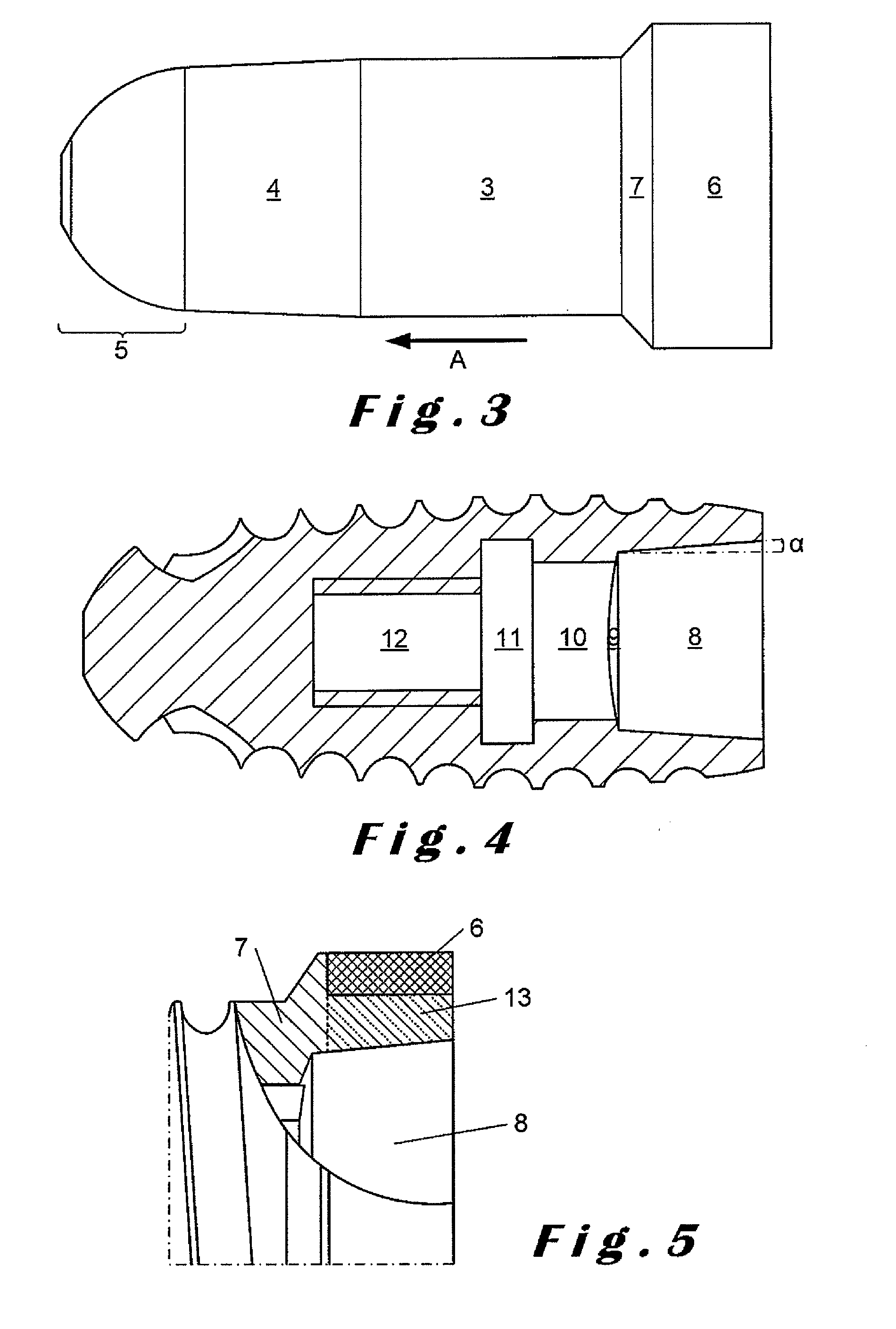 Implant dentaire