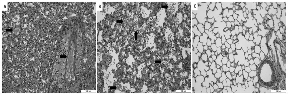 Application of tirofiban in preparation of medicine for treating human respiratory syncytial virus infection