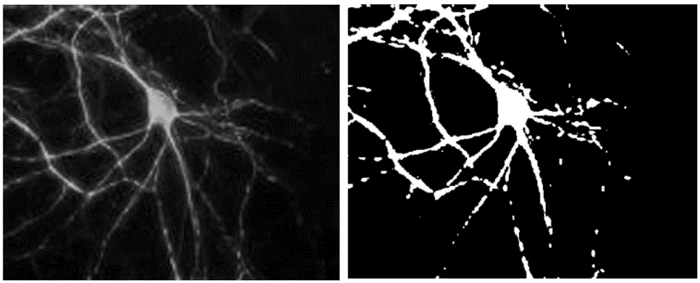 Image classification method of neural dendritic spines based on multi-resolution fractal features