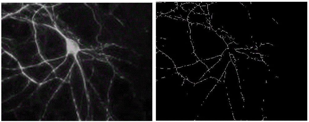 Image classification method of neural dendritic spines based on multi-resolution fractal features