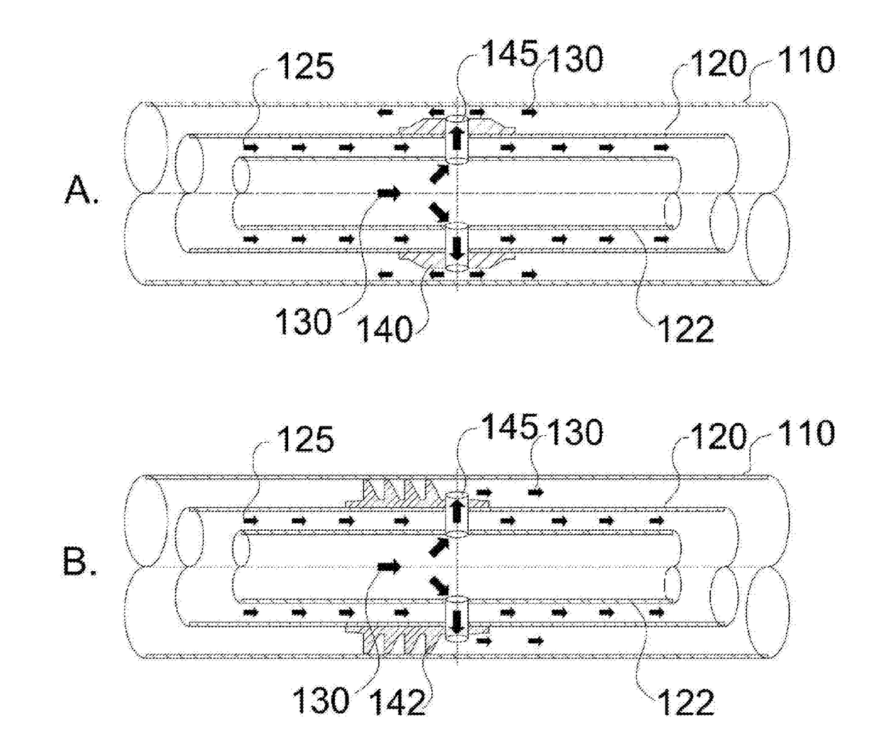 Moving injection gravity drainage for heavy oil recovery