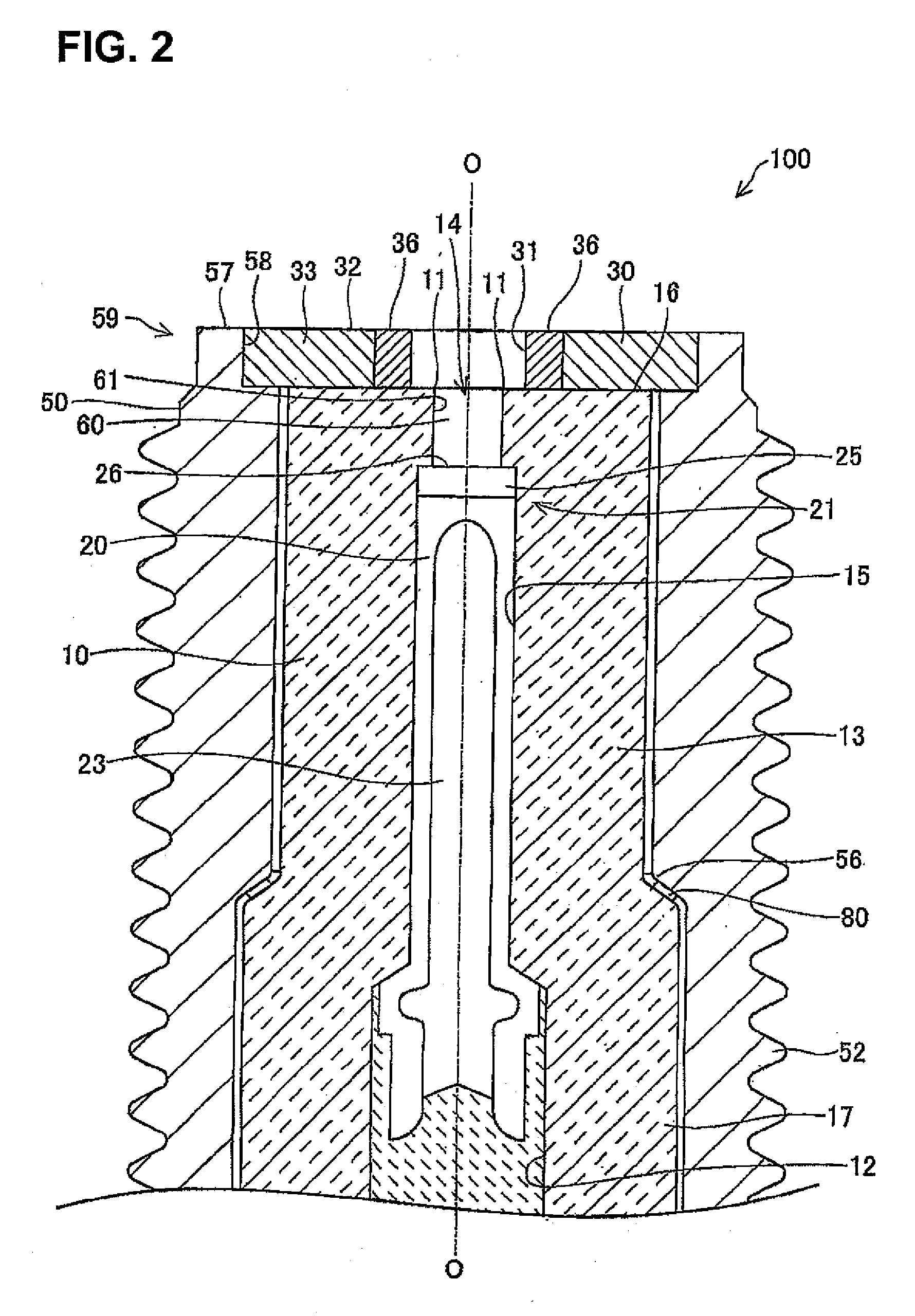 Method for manufacturing ignition plug