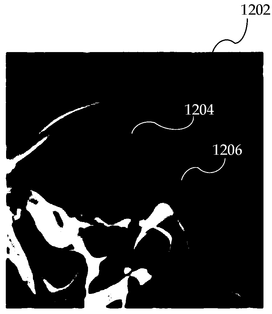 Isolation of aneurysm and parent vessel in volumetric image data