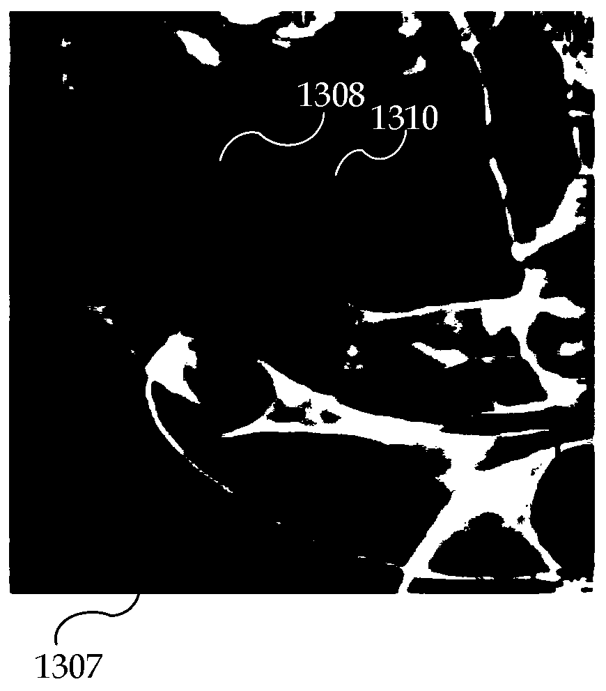 Isolation of aneurysm and parent vessel in volumetric image data