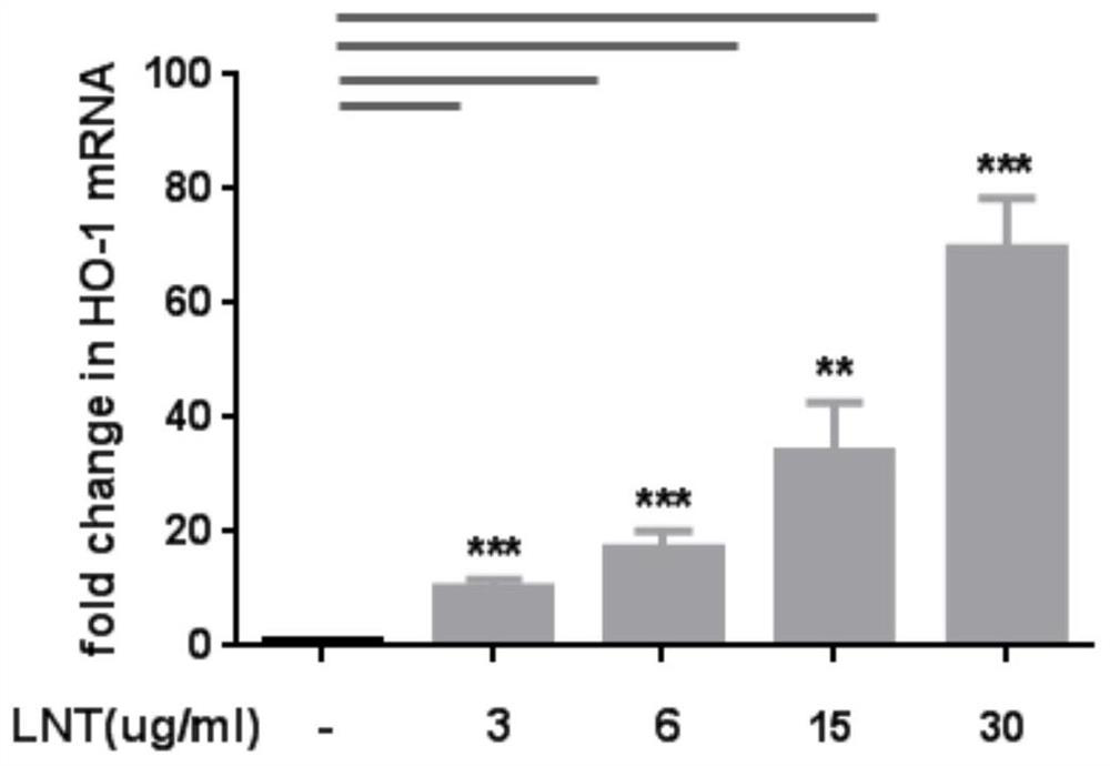 New application of lentinan extract and skin care composition with anti-smog effect and preparation method thereof