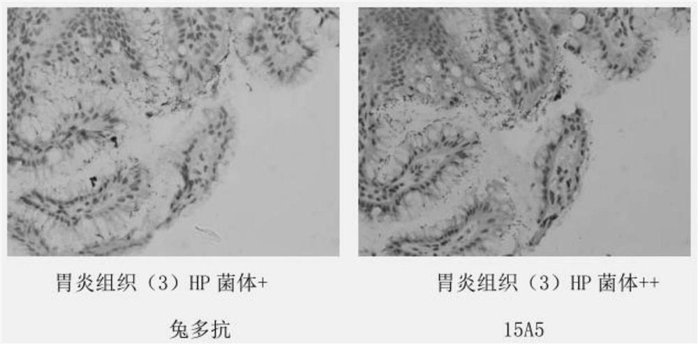 Anti-helicobacter pylori protein monoclonal antibody and its cell line, preparation method and application