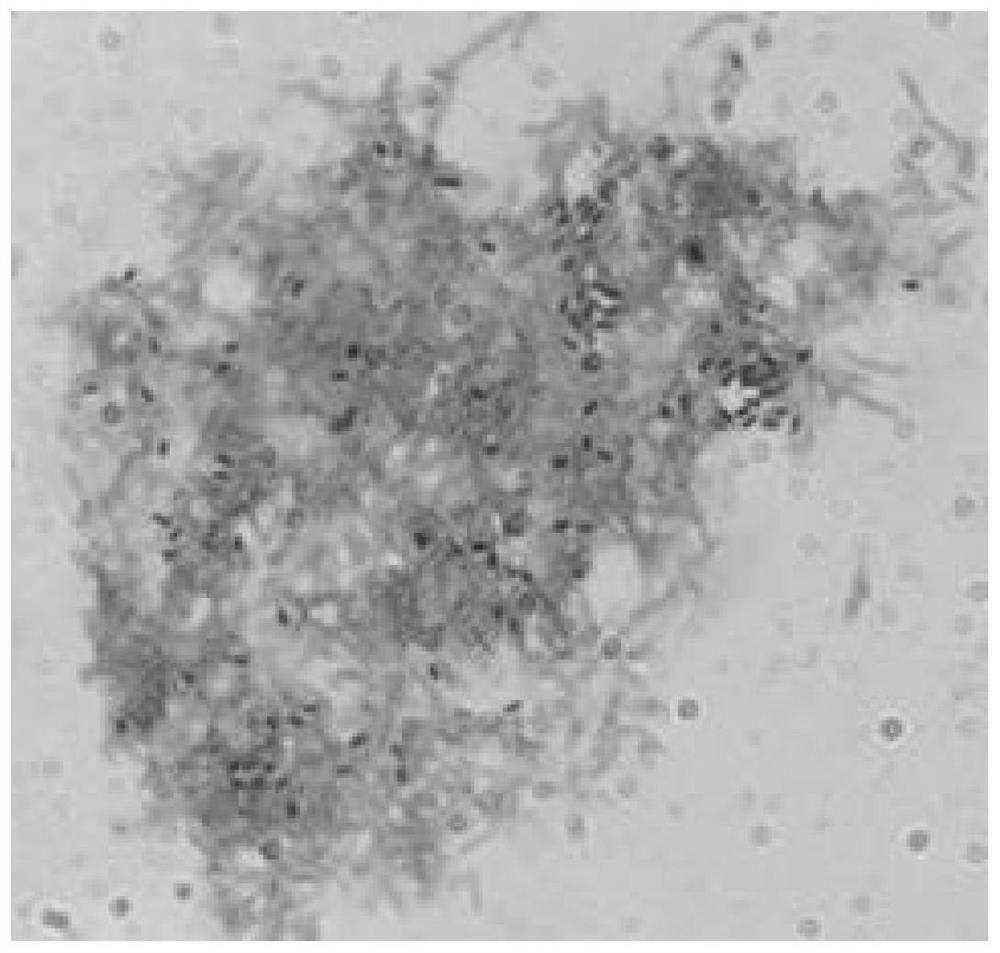 Method for preparing Paenibacillus polymyxa biopesticide wettable powder by liquid fermentation and formulation