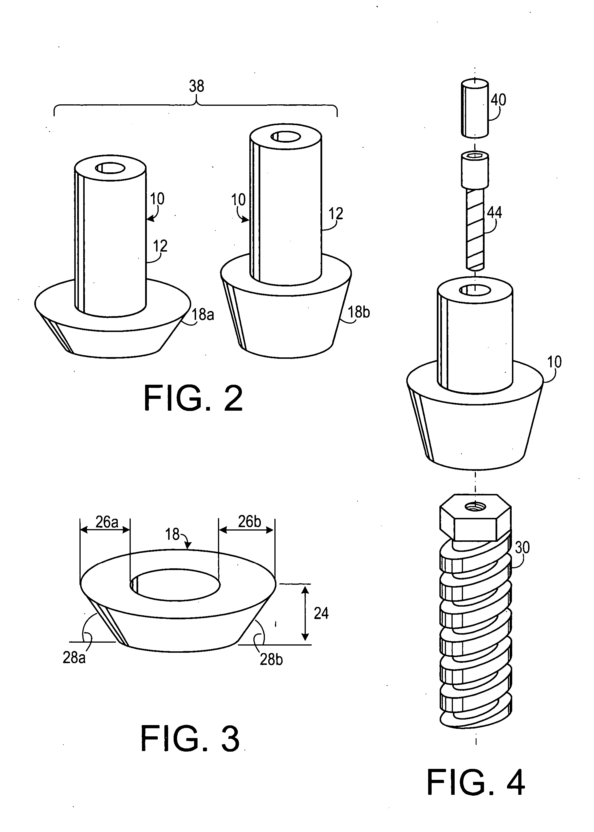 Abutment system