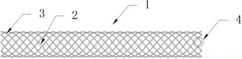 Woven vascular stent